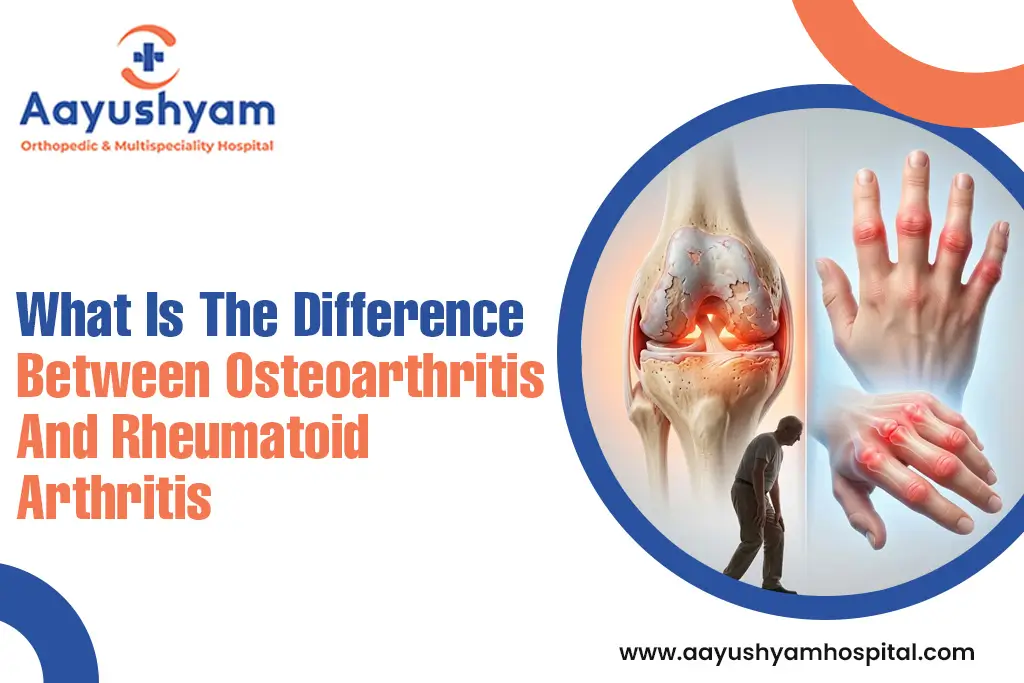 What is the Difference Between Osteoarthritis and Rheumatoid Arthritis