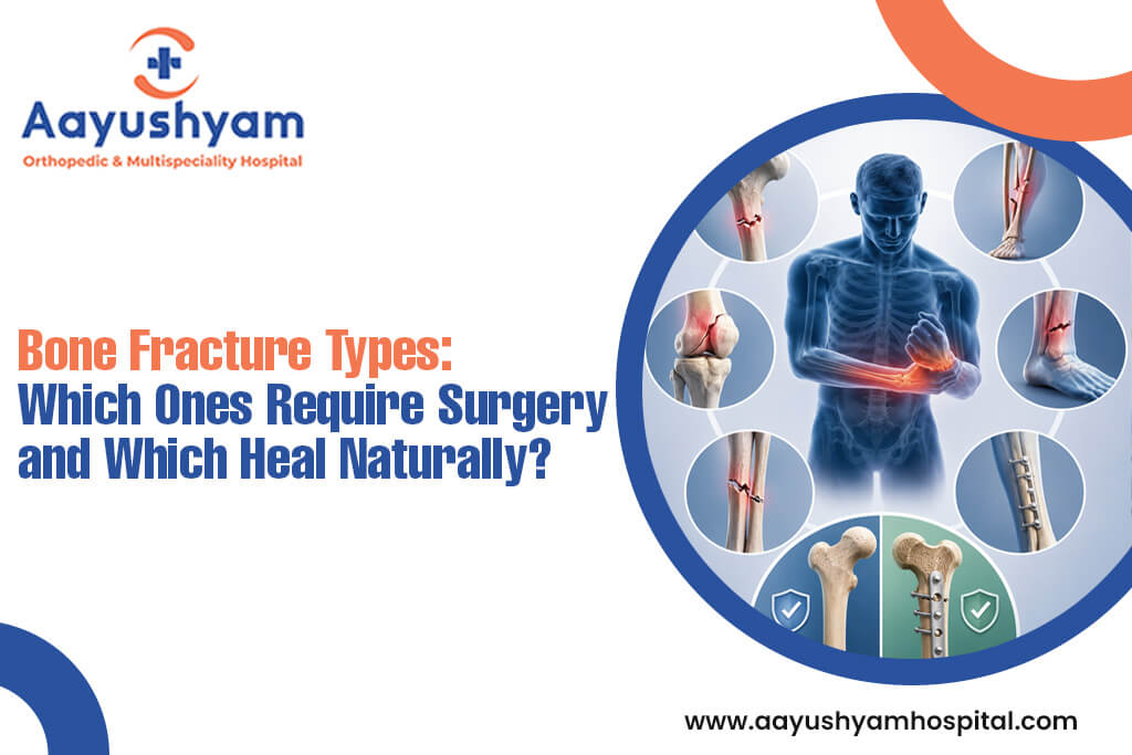 Bone Fracture Types: Which Ones Require Surgery and Which Heal Naturally?